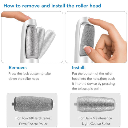 SoleRefine Electric Foot Refiner