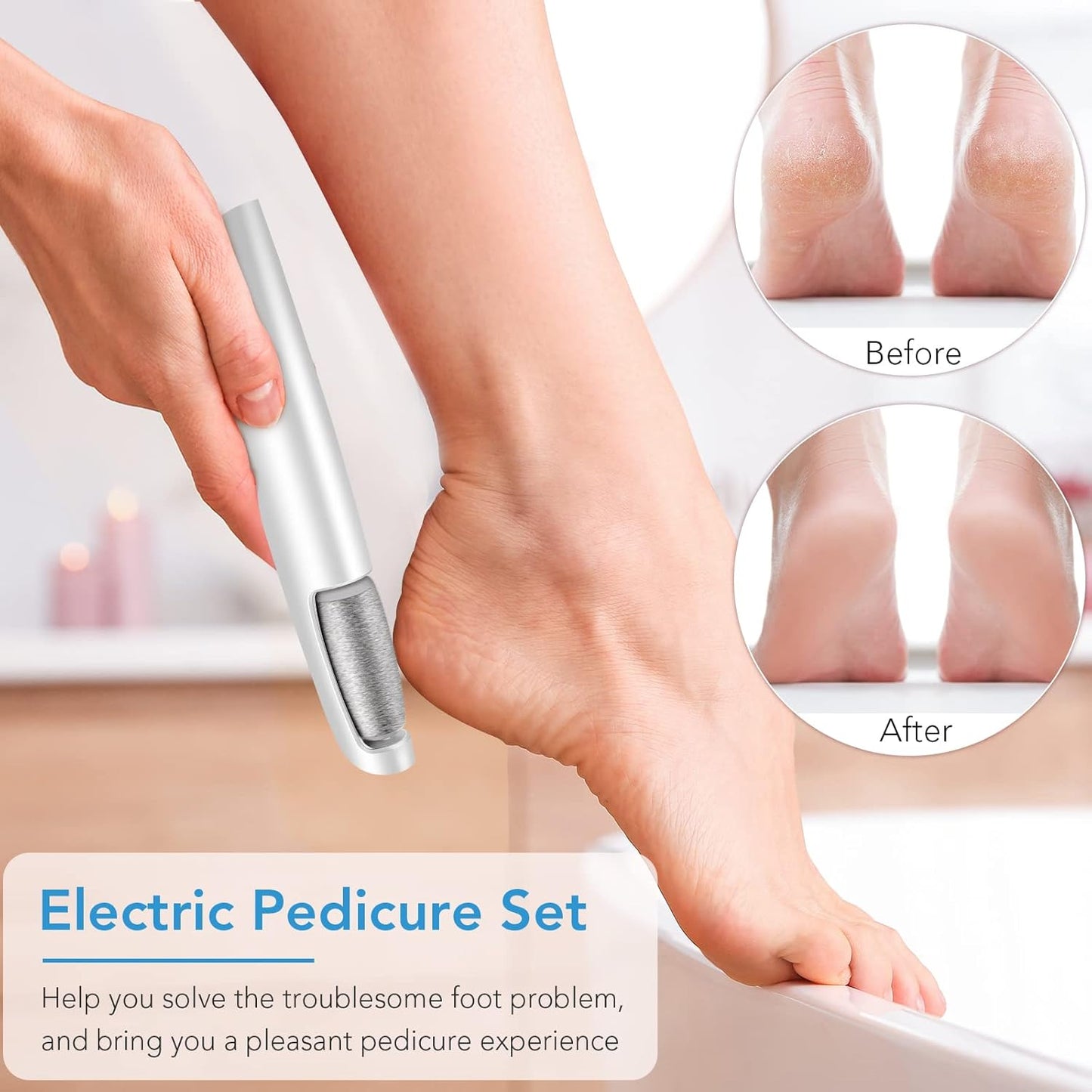 SoleRefine Electric Foot Refiner